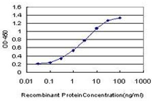 Detection limit for recombinant GST tagged FGFR1 is approximately 0. (FGFR1 anticorps  (AA 31-150))