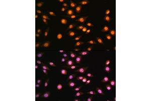 Immunofluorescence analysis of L929 cells using NR2F2 Rabbit pAb (ABIN6133831, ABIN6144820, ABIN6144821 and ABIN6214430) at dilution of 1:100.