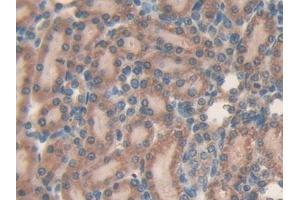 DAB staining on IHC-P; Samples: Rat Kidney Tissue