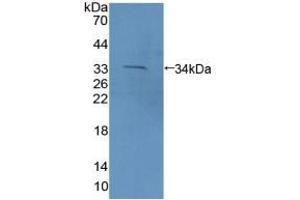 Detection of Recombinant PCDH15, Mouse using Polyclonal Antibody to Protocadherin 15 (PCDH15) (PCDH15 anticorps  (AA 45-270))