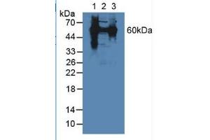 Rabbit Detection antibody from the kit in WB with Positive Control: Sample Lane1: Mouse Liver Tissue; Lane2: Mouse Lung Tissue; Lane3: Human Hela Cells. (HSPD1 Kit ELISA)
