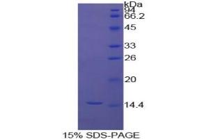 SDS-PAGE analysis of Cow Inhibin beta A Protein. (INHBA Protéine)