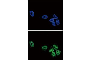 Confocal immunofluorescent analysis of PLA2G4A Antibody (Center) (ABIN652449 and ABIN2842304) with NCI- cell followed by Alexa Fluor? (PLA2G4A anticorps  (AA 513-541))