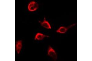 ABIN6268893 staining HepG2 by IF/ICC. (Integrin beta 4 anticorps  (C-Term))