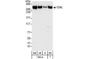 Western Blotting (WB) image for anti-Nucleoprotein TPR (TPR) (AA 2275-2325) antibody (ABIN7452110)