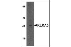 Western blot analysis of KLRA3 in mouse brain tissue lysate with this product at 2 μg/ml. (Klra3 anticorps  (C-Term))