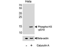 Western blot analysis of lysate from HeLa cell line, untreated or treated with Calyculin A (100ng/ml), using phospho-Histone H3 antibody
