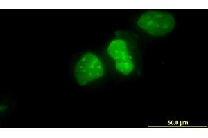 Immunofluorescence of monoclonal antibody to XRCC6 on HeLa cell. (XRCC6 anticorps  (AA 1-609))