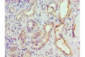 Immunohistochemistry of paraffin-embedded human kidney tissue using ABIN7153301 at dilution of 1:100 (GRK6 anticorps  (AA 1-170))