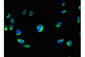 Immunofluorescence staining of A549 cells with ABIN7145860 at 1:100, counter-stained with DAPI. (KCTD7 anticorps  (AA 5-152))