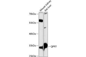 Western blot analysis of extracts of various cell lines, using QPRT antibody (ABIN7269781) at 1:3000 dilution. (QPRT anticorps  (AA 1-297))