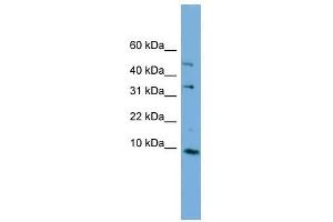 C16ORF61 antibody used at 1 ug/ml to detect target protein. (C16orf61 anticorps  (Middle Region))