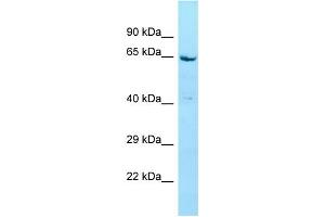 WB Suggested Anti-STXBP4 Antibody Titration: 1. (STXBP4 anticorps  (N-Term))