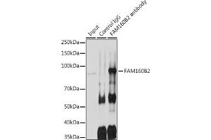 Immunoprecipitation analysis of 600 μg extracts of Rat testis cells using 3 μg FB2 antibody (ABIN7267112). (FAM160B2 anticorps)