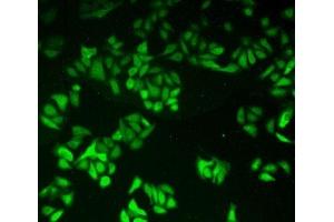 Detection of GR in Human Hela Cells using Polyclonal Antibody to Glutathione Reductase (GR)
