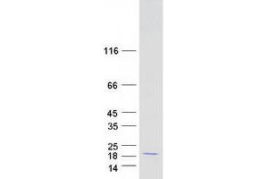 Validation with Western Blot