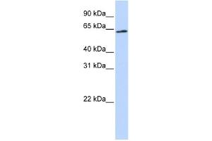 WB Suggested Anti-AIFM3 Antibody Titration: 0. (AIFM3 anticorps  (Middle Region))