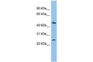 C1orf102 antibody used at 1 ug/ml to detect target protein.