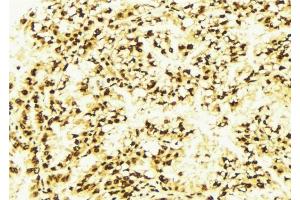 ABIN6277282 at 1/100 staining Human lung tissue by IHC-P. (PDCD4 anticorps  (N-Term))