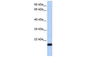 GPX4 antibody used at 1 ug/ml to detect target protein. (GPX4 anticorps)