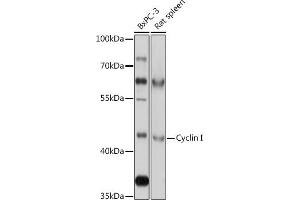 Western blot analysis of extracts of various cell lines, using Cyclin I antibody (ABIN7266570) at 1:1000 dilution. (Cyclin I anticorps  (AA 257-377))