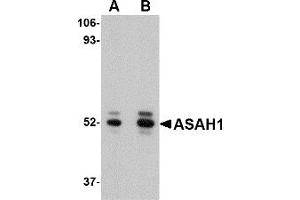 Western Blotting (WB) image for anti-N-Acylsphingosine Amidohydrolase (Acid Ceramidase) 1 (ASAH1) (C-Term) antibody (ABIN1030257) (ASAH1 anticorps  (C-Term))