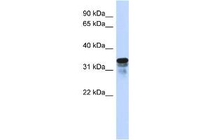 WB Suggested Anti-FAM82B Antibody Titration:  0. (FAM82B anticorps  (N-Term))