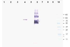 Image no. 1 for anti-Ankyrin Repeat Domain 26 (ANKRD26) (AA 1-15), (N-Term) antibody (ABIN401330) (ANKRD26 anticorps  (N-Term))