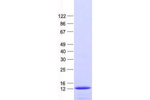 Validation with Western Blot