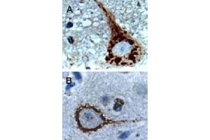 Formalin-fixed, paraffin-embedded dog brain sections stained for Active/Cleaved CASP9 expression using CASP9 polyclonal antibody  at 1 : 2000. (Caspase 9 anticorps)