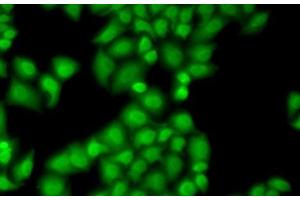 Immunofluorescence analysis of MCF7 cells using GTF2F1 Polyclonal Antibody (GTF2F1 anticorps)