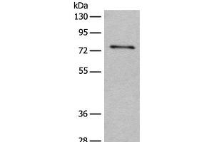 Western blot analysis of Human hepatocellular carcinoma 2 tissue lysate using ADGRE3 Polyclonal Antibody at dilution of 1:400 (EMR3 anticorps)