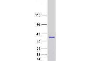 Validation with Western Blot