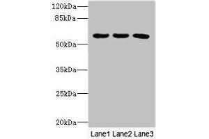 Western blot All lanes: PIK3R3 antibody at 3. (PIK3R3 anticorps  (Regulatory Subunit Gamma))