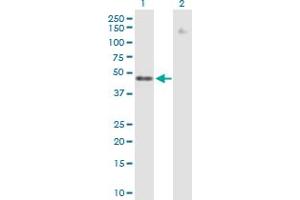 Western Blot analysis of ZNF776 expression in transfected 293T cell line by ZNF776 MaxPab polyclonal antibody. (ZNF776 anticorps  (AA 1-476))