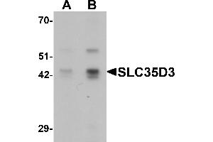 Western Blotting (WB) image for anti-Solute Carrier Family 35, Member D3 (SLC35D3) (C-Term) antibody (ABIN1077364) (SLC35D3 anticorps  (C-Term))