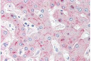 anti-Low Density Lipoprotein Receptor-Related Protein 1 (LRP1) antibody