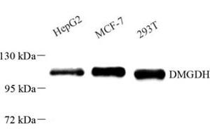 Western blot analysis of DMGDH (ABIN7073738) at dilution of 1: 500 (DMGDH anticorps)