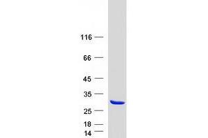 Validation with Western Blot