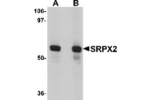 Western Blotting (WB) image for anti-Sushi-Repeat Containing Protein, X-Linked 2 (SRPX2) (N-Term) antibody (ABIN1031586) (SRPX2 anticorps  (N-Term))