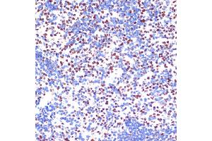 Immunohistochemistry of paraffin-embedded mouse spleen using PELP1 antibody (ABIN6130610, ABIN6145442, ABIN6145443 and ABIN6217403) at dilution of 1:100 (40x lens). (PELP1 anticorps)