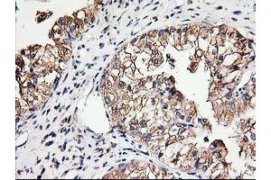 Image no. 7 for anti-Tubulin beta 4a (TUBB4A) antibody (ABIN1501580)