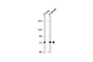 All lanes : Anti-SLC6A14 Antibody (C-term) at 1:1000 dilution Lane 1: Human lung lysate Lane 2: Human breast lysate Lysates/proteins at 20 μg per lane.