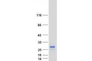 Validation with Western Blot