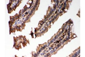 IHC testing of FFPE mouse intestine with HLA-C antibody. (HLA-C anticorps)