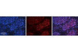 Rabbit Anti-HDAC2 Antibody   Formalin Fixed Paraffin Embedded Tissue: Human Testis Tissue Observed Staining: Nucleus, Cytoplasm Primary Antibody Concentration: 1:600 Other Working Concentrations: 1:600 Secondary Antibody: Donkey anti-Rabbit-Cy3 Secondary Antibody Concentration: 1:200 Magnification: 20X Exposure Time: 0.