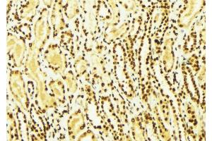 ABIN6269069 at 1/100 staining Mouse kidney tissue by IHC-P. (SNAIL anticorps  (C-Term))