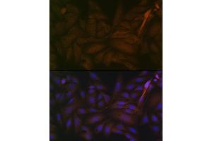 Immunofluorescence analysis of U-2 OS cells using PP2A alpha + beta Rabbit mAb (ABIN7269686) at dilution of 1:100 (40x lens).