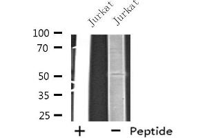 Western blot analysis of extracts from Jurkat cells, using EIF2B3 antibody.