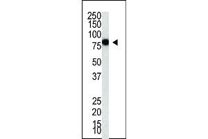 The PIASy1 polyclonal antibody (ABIN388062 and ABIN2845727) is used in Western blot to detect recombinant GST-PIASy1 in bacterial cell lysate.